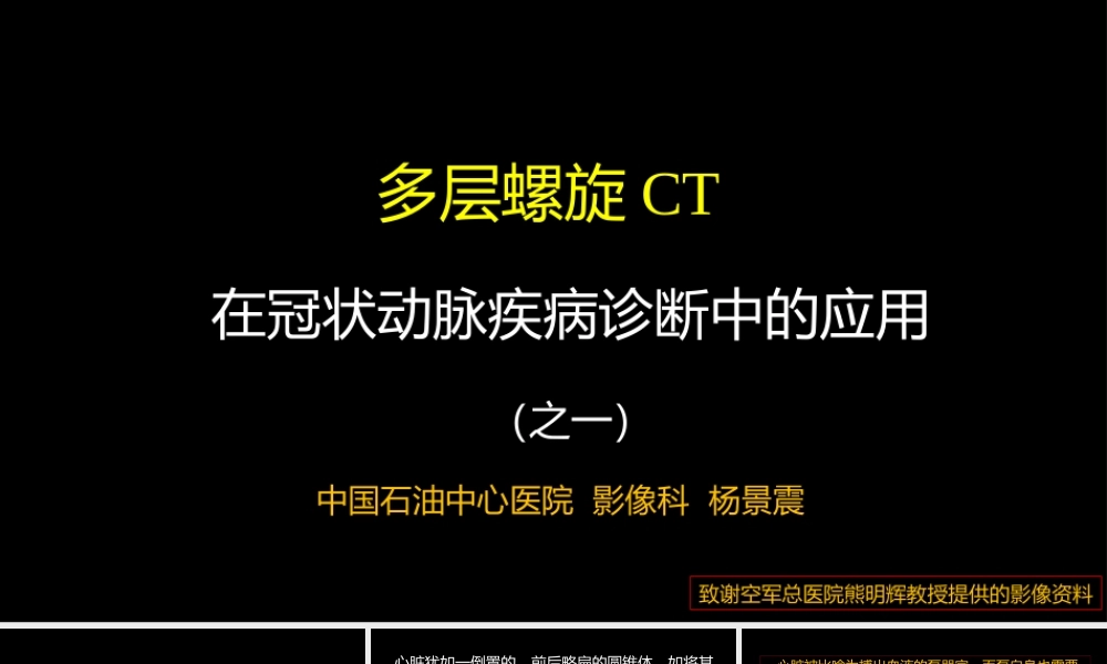 多层螺旋CT冠状动脉疾病诊断再学习之一(1).ppt
