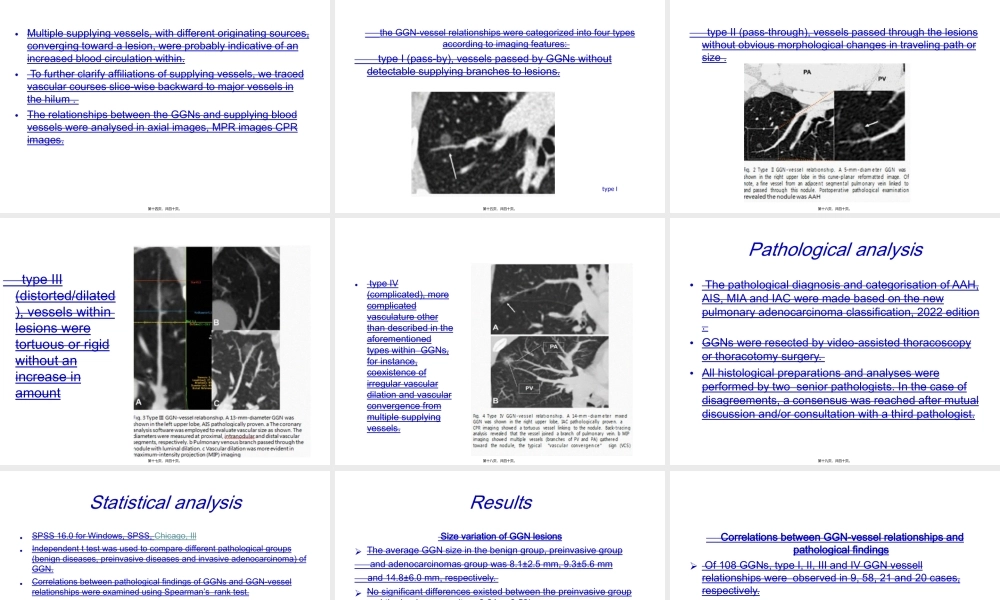 多层螺旋CT肺结节和血管的关系.ppt