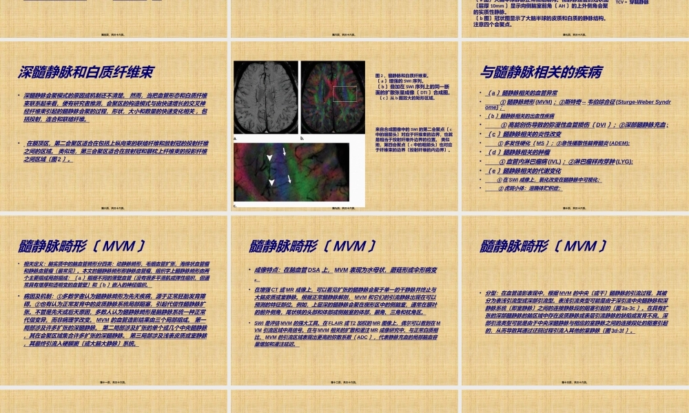 大脑半球髓静脉结构及相关异常-影像学分析.ppt