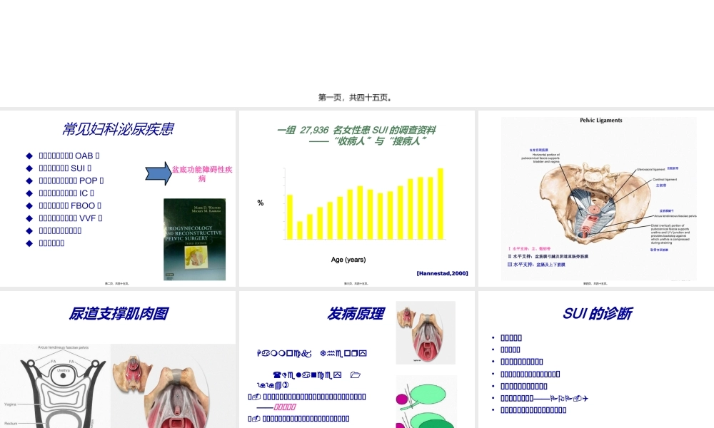 女性压力性尿失禁.ppt