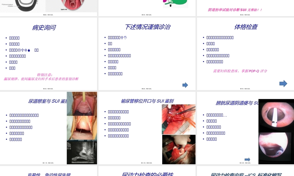 女性压力性尿失禁.ppt