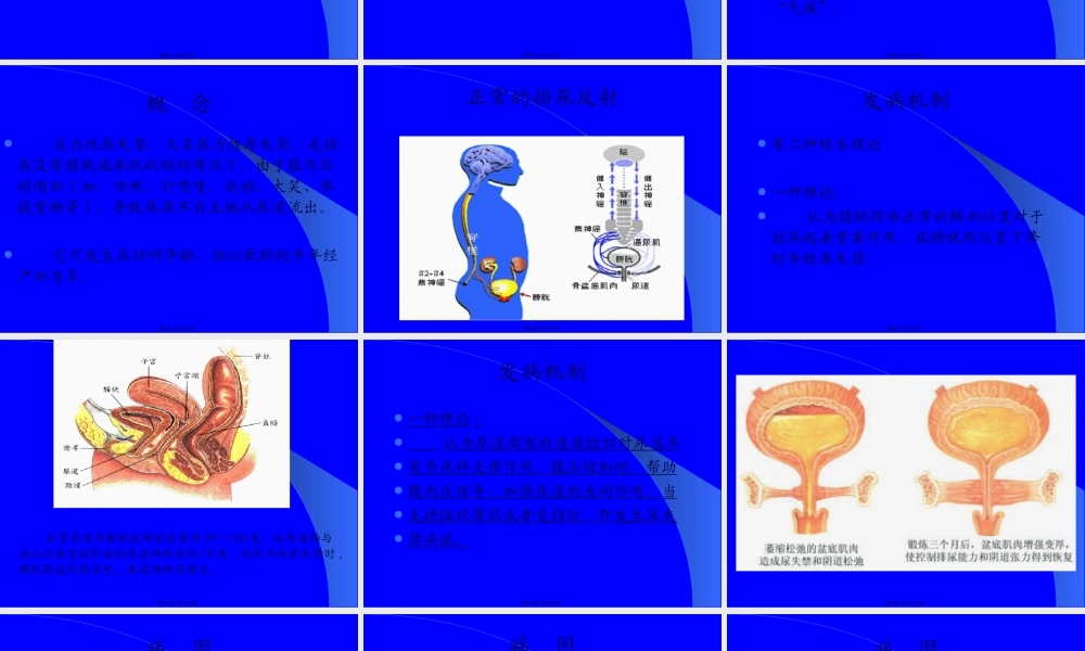 女性压力性尿失禁.pptx