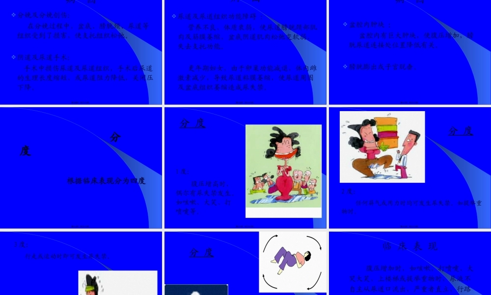 女性压力性尿失禁.pptx