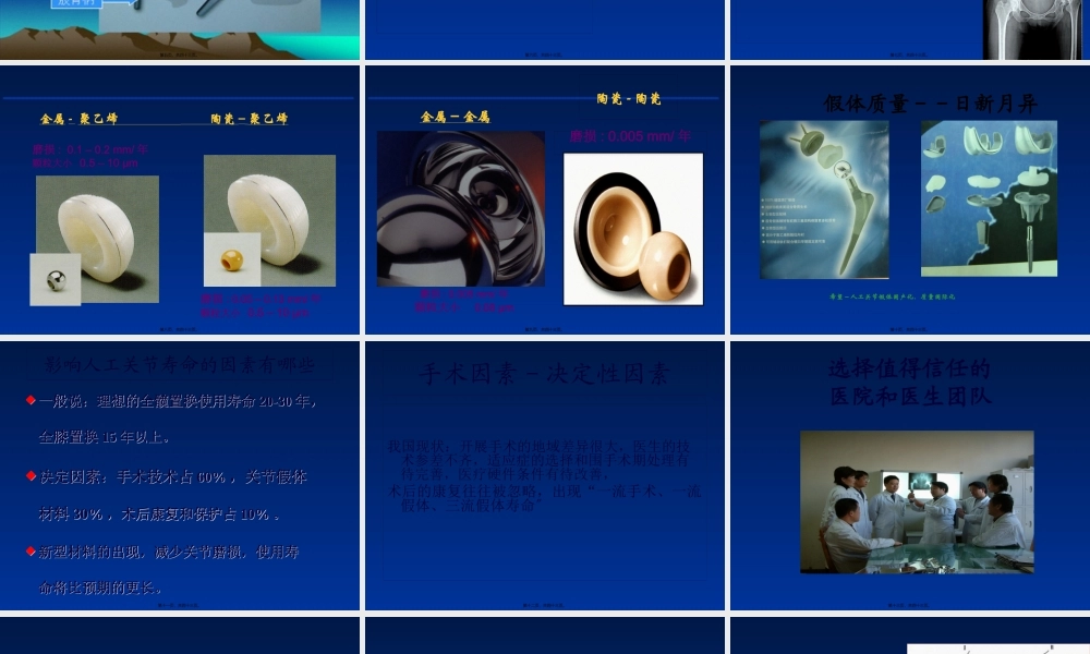 如何延长人工关节的寿命.pptx