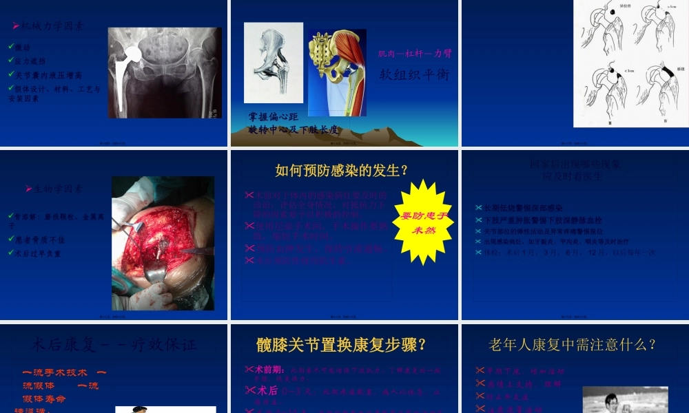 如何延长人工关节的寿命.pptx