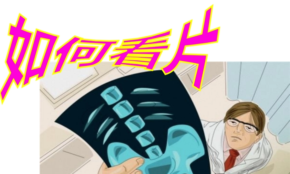 如何看颈腰椎X光片.pptx