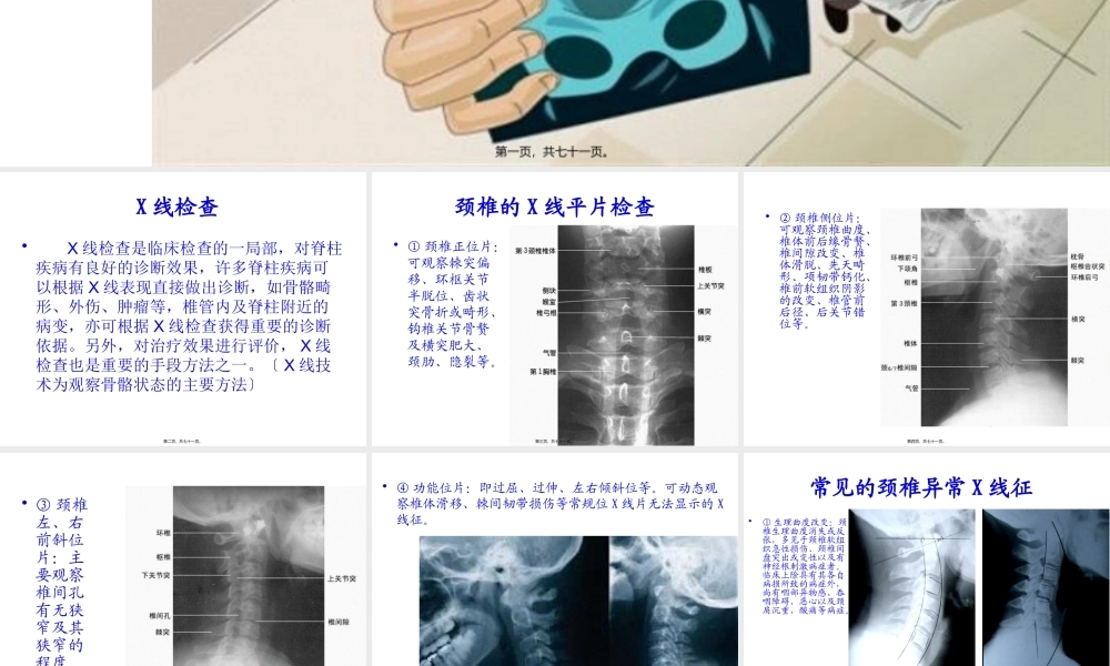 如何看颈腰椎X光片.pptx