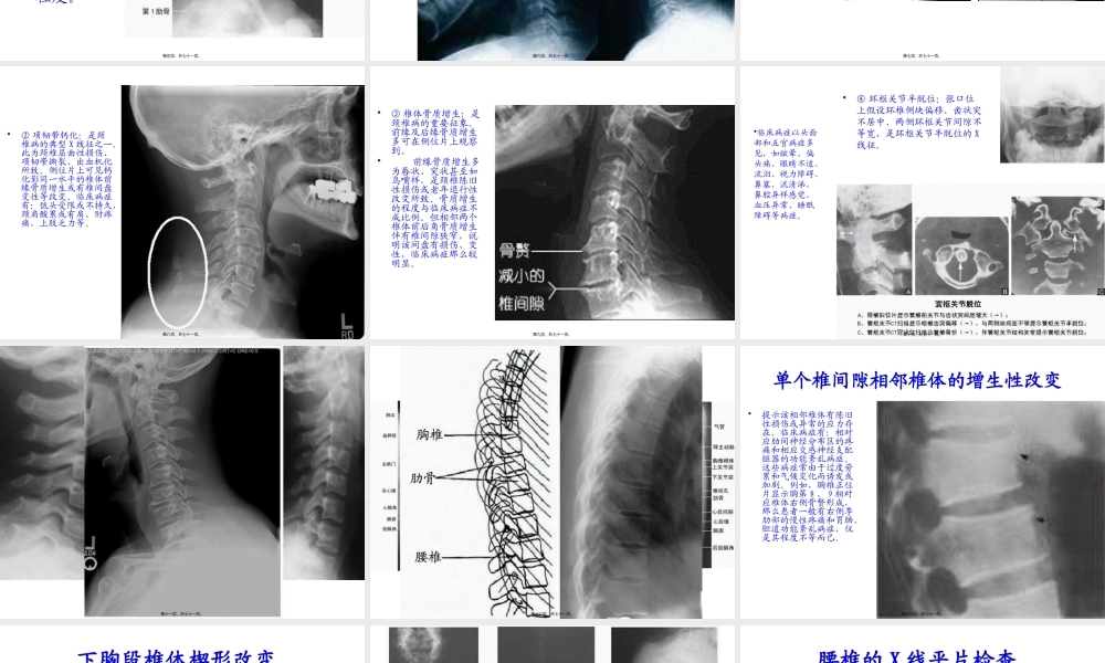 如何看颈腰椎X光片.pptx