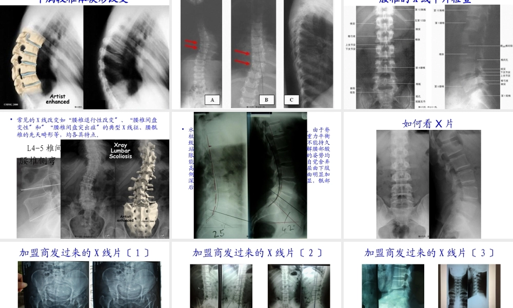 如何看颈腰椎X光片.pptx