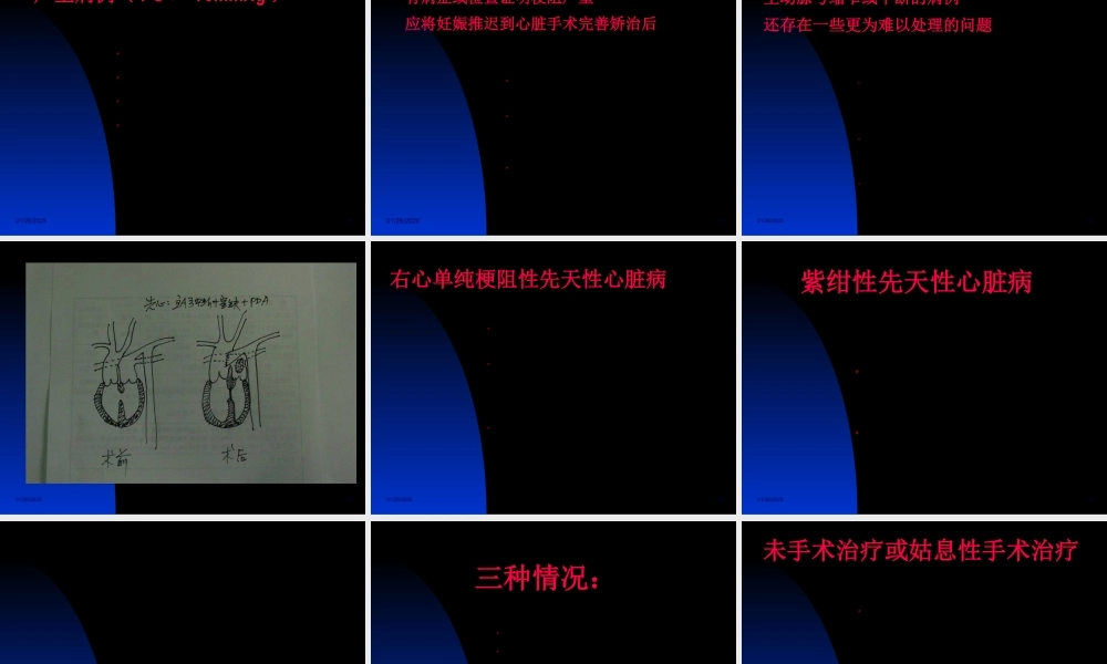 妊娠合并心脏病的外科干预策略和预后.pptx