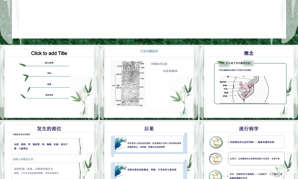 子宫内膜异位症.pptx