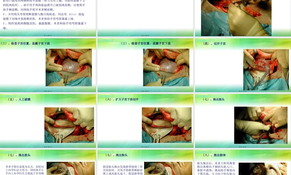 子宫下段剖宫产.ppt