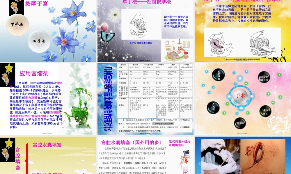 子宫收缩乏力性出血的处理.pptx