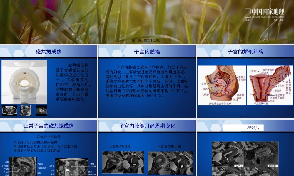 子宫内膜癌MRI影像表现.pptx