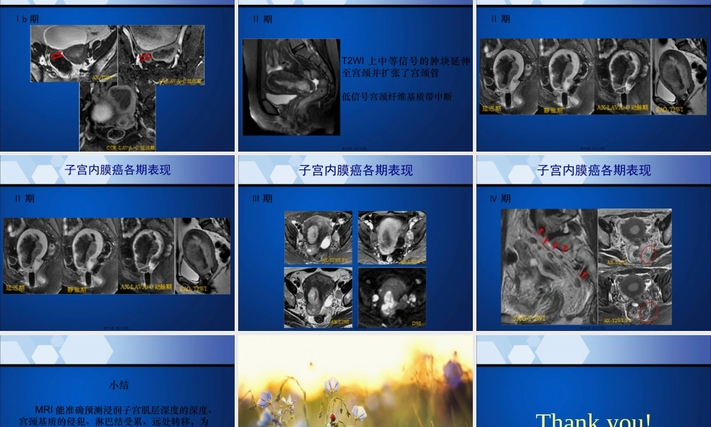 子宫内膜癌MRI影像表现.pptx