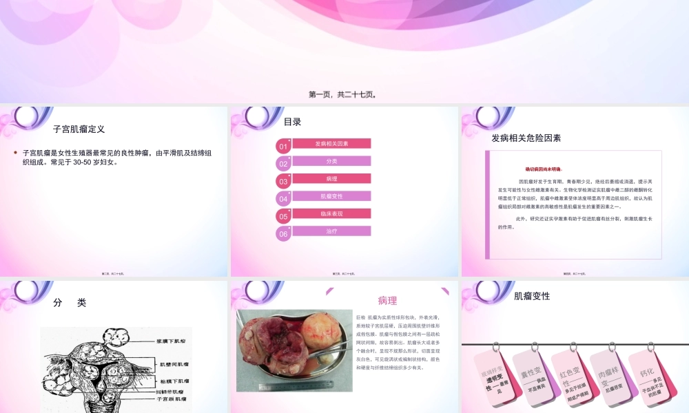 子宫肌瘤.ppt