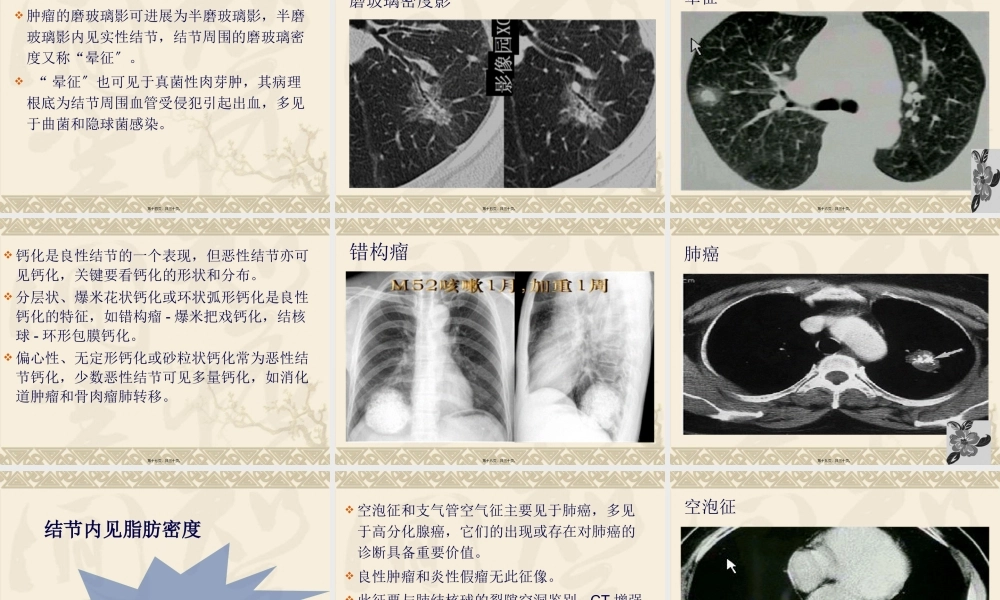 孤立性肺结节.pptx