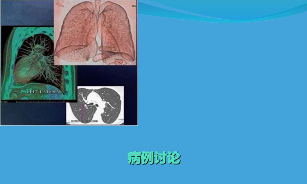 孤立性肺结节.ppt