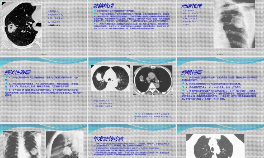孤立性肺结节.ppt