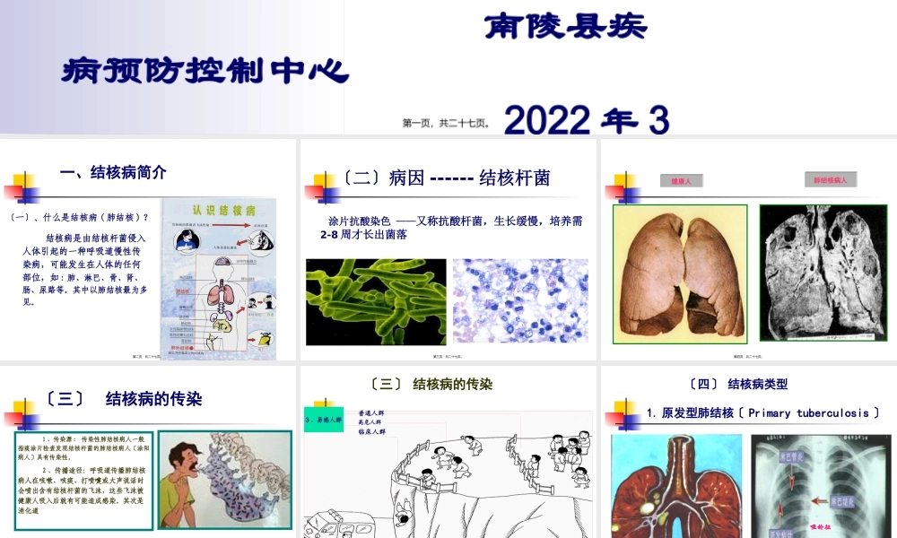 学校结核病(学生).pptx