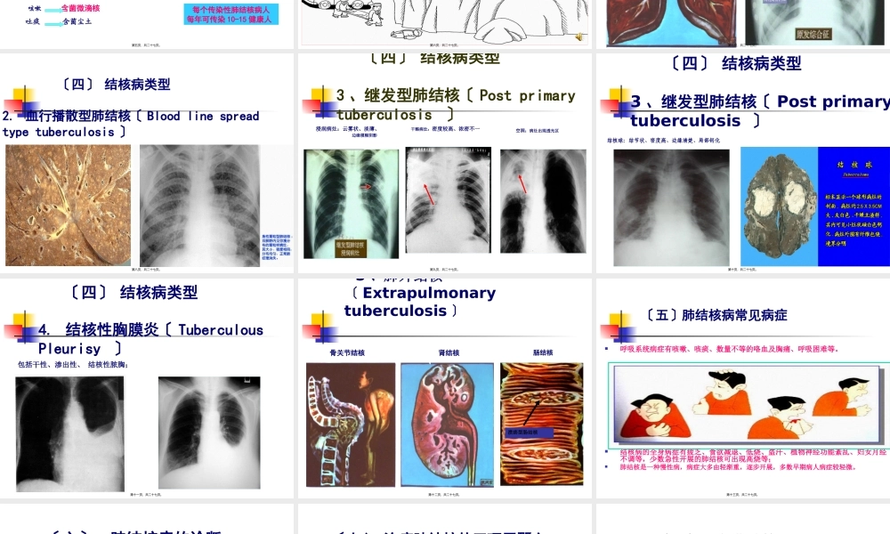 学校结核病(学生).pptx