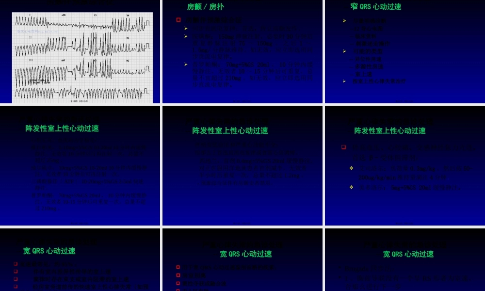 实用急诊心电图的识别与处置★.pptx