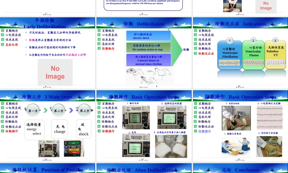室颤与急救.pptx