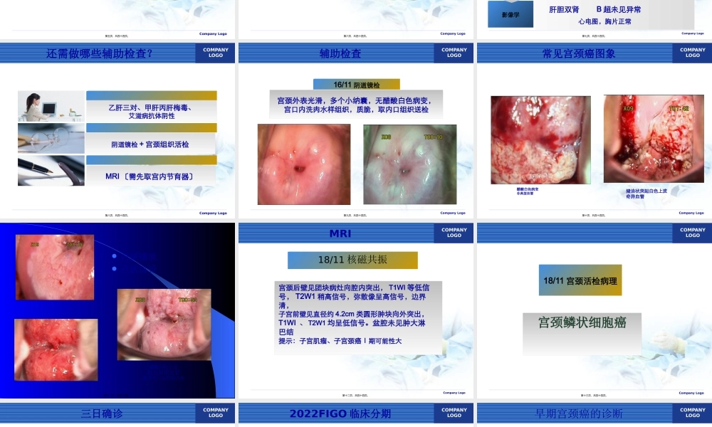 宫颈癌诊治新策略.pptx