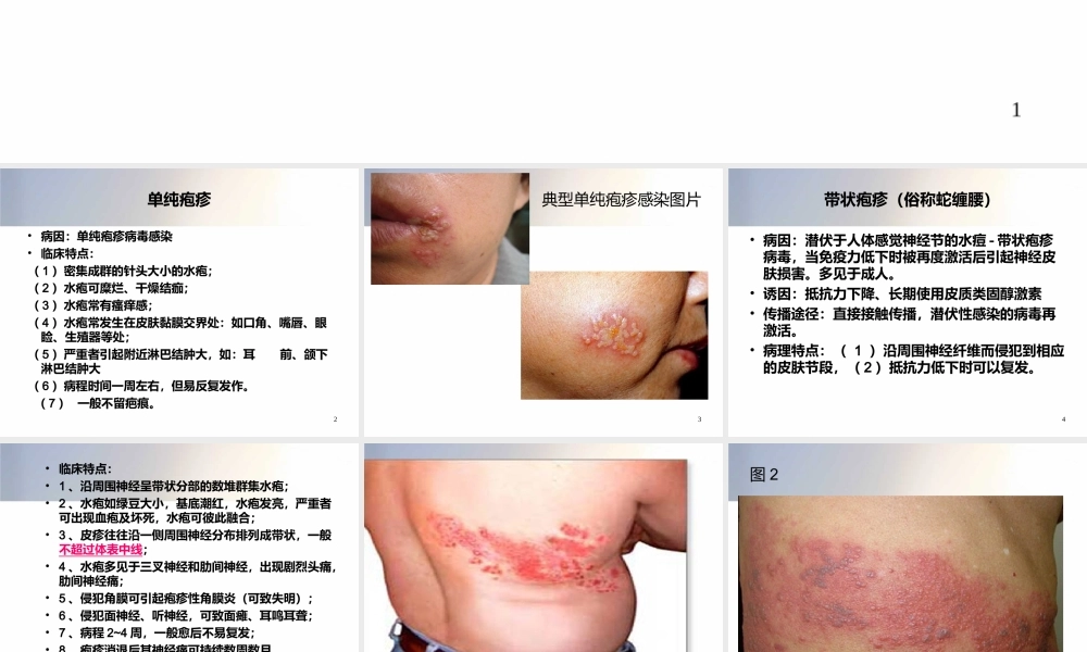 常见皮肤病资料.ppt