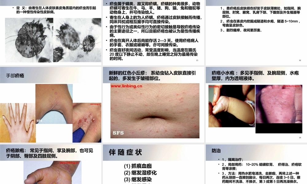 常见皮肤病资料.ppt