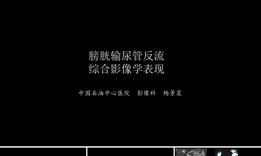 影像科容易忽略的病：膀胱输尿管反流(1).pptx