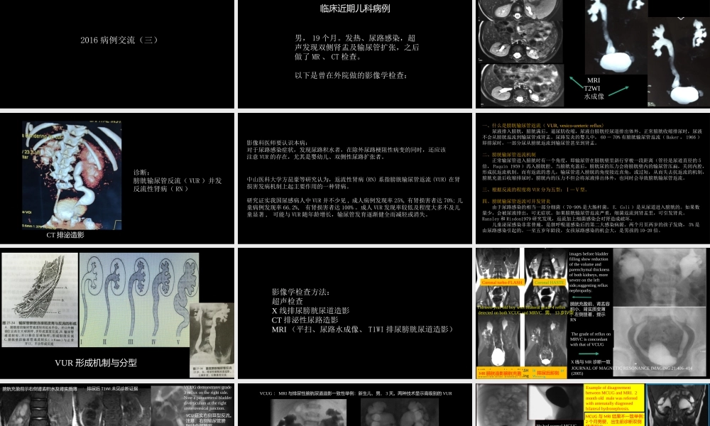 影像科容易忽略的病：膀胱输尿管反流(1).pptx