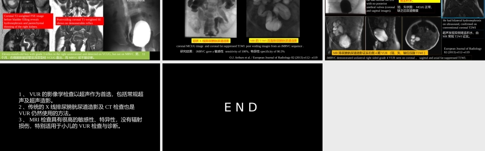 影像科容易忽略的病：膀胱输尿管反流(1).pptx