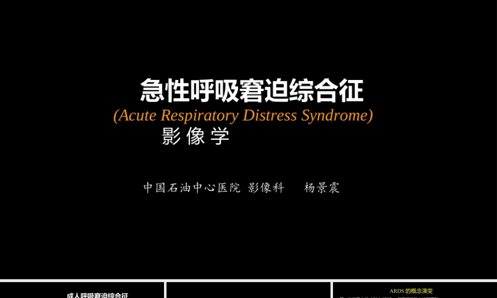 急性呼吸窘迫综合征(ARDS)的-影像学表现(1).ppt