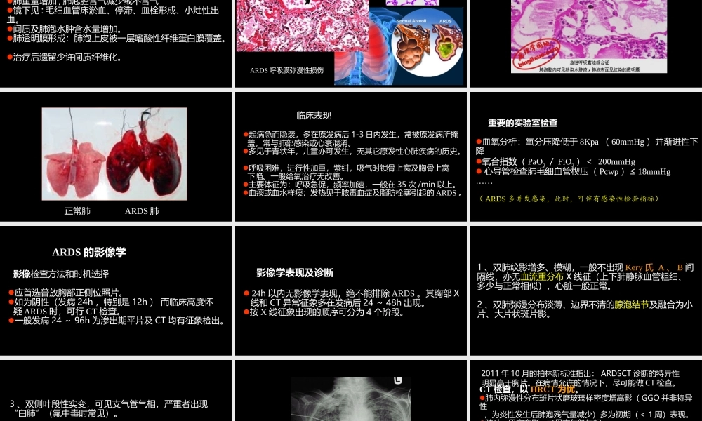 急性呼吸窘迫综合征(ARDS)的-影像学表现(1).ppt