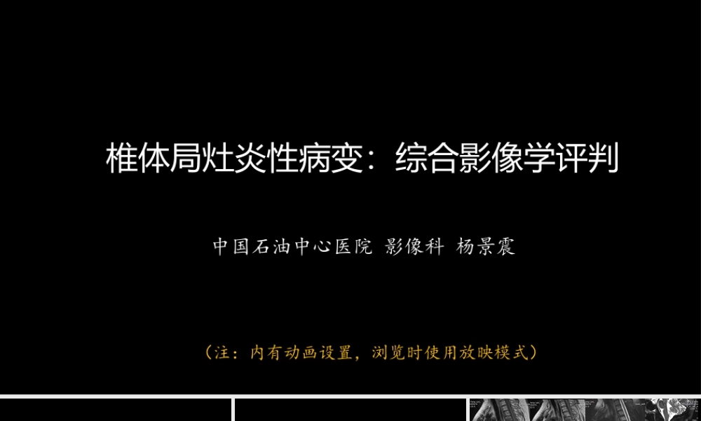 椎体局灶性病变：综合影像学评判(1).ppt