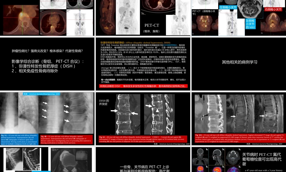 椎体局灶性病变：综合影像学评判(1).ppt