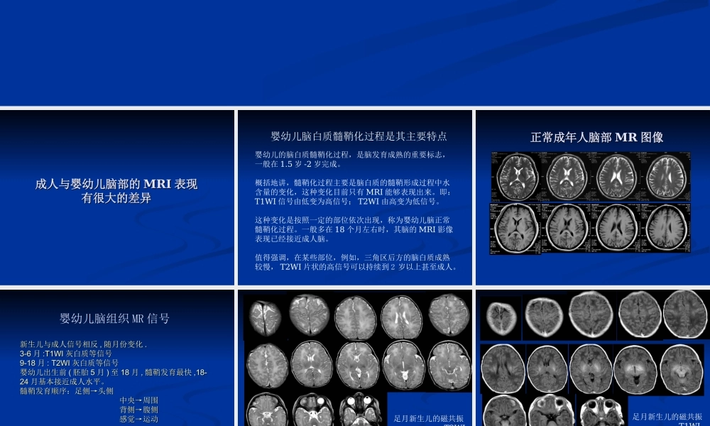 新生儿缺氧缺血性(1).ppt