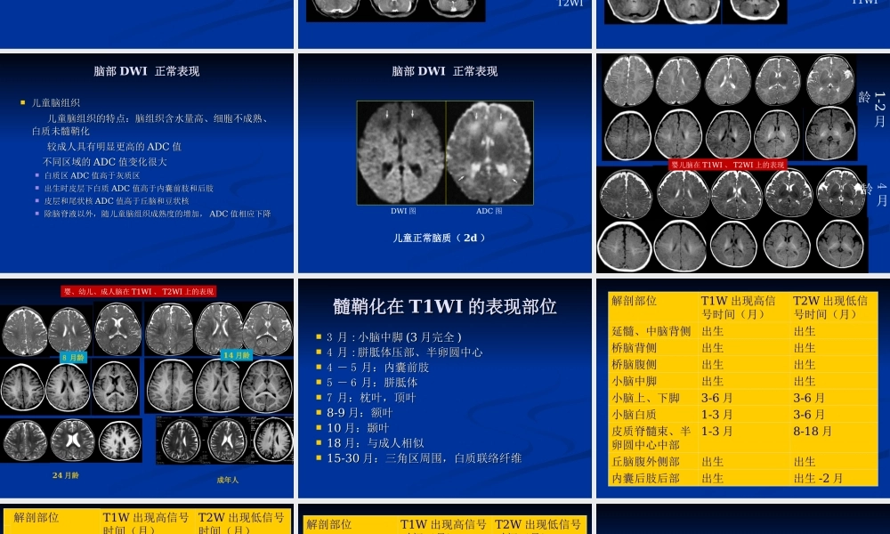 新生儿缺氧缺血性(1).ppt