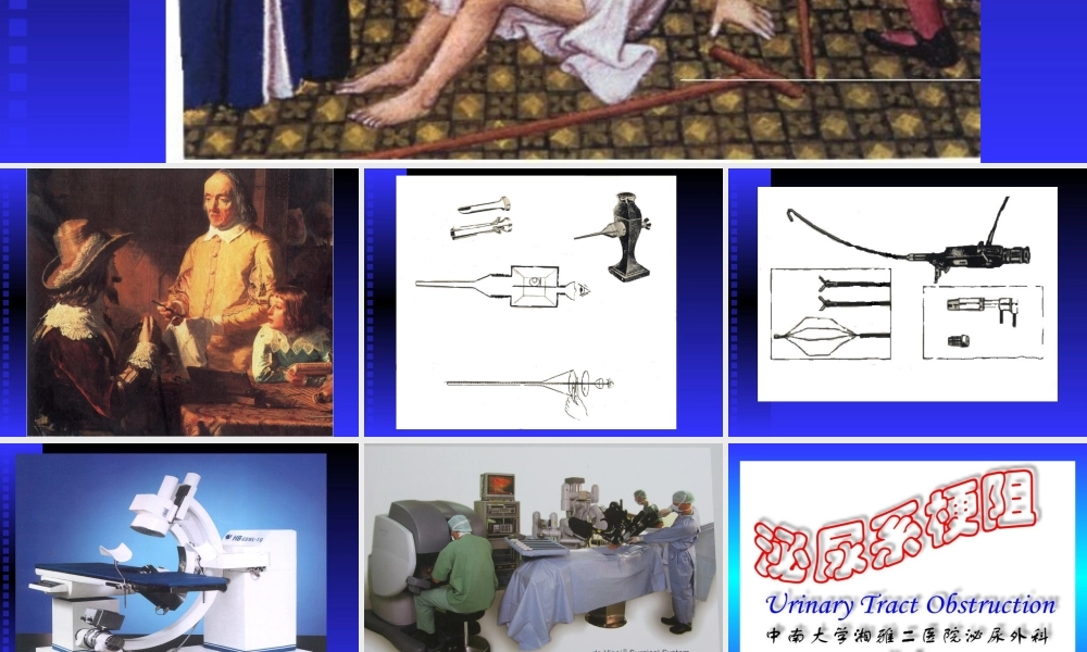 泌尿系梗阻双语版2012[2月](1).ppt