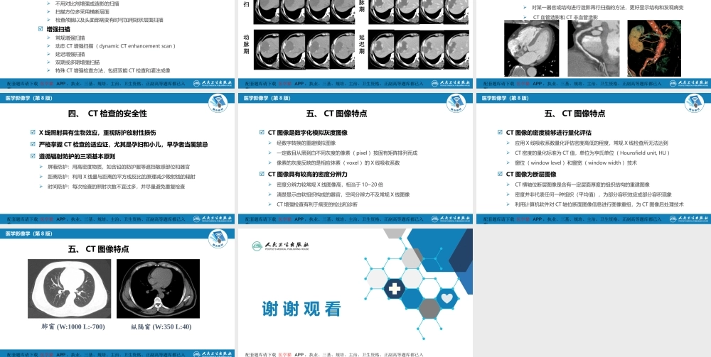 第一章 影像诊断学总论 第二节 X线计算机体层成像(1).pptx