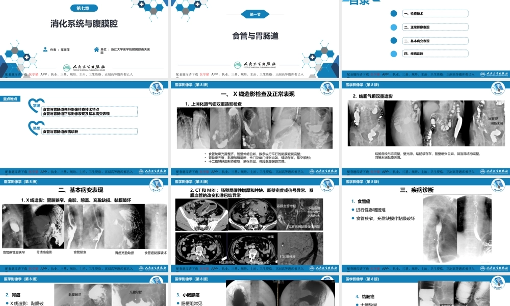 第七章 消化系统与腹膜腔 第一节 食管与胃肠道(1).pptx