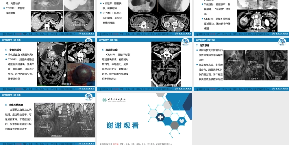 第七章 消化系统与腹膜腔 第一节 食管与胃肠道(1).pptx