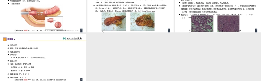 第三十七章 结、直肠与肛管疾病 案例分析-直肠癌(1).pptx