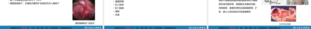 第三十七章 结、直肠与肛管疾病 第八节 结直肠和肛管疾病(1).pptx