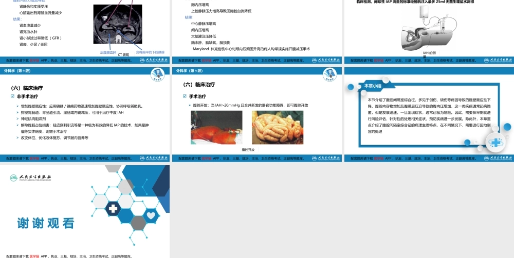 第三十三章 急性化脓性腹膜炎 第三节 腹腔间隔室综合征(1).pptx