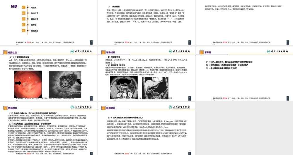 第三十四章 胃十二指肠疾病 案例分析-胃癌(1).pptx