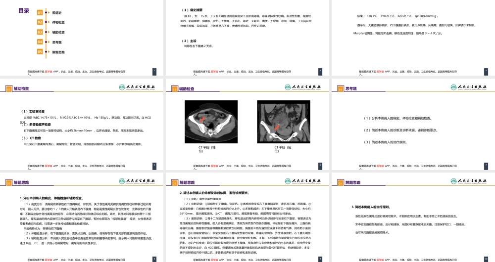 第三十六章 阑尾疾病 案例分析-急性化脓性阑尾炎(1).pptx
