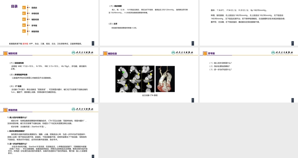 第三十章 胸主动脉疾病 案例分析-急性Stanford B 型主动脉夹层(1).pptx