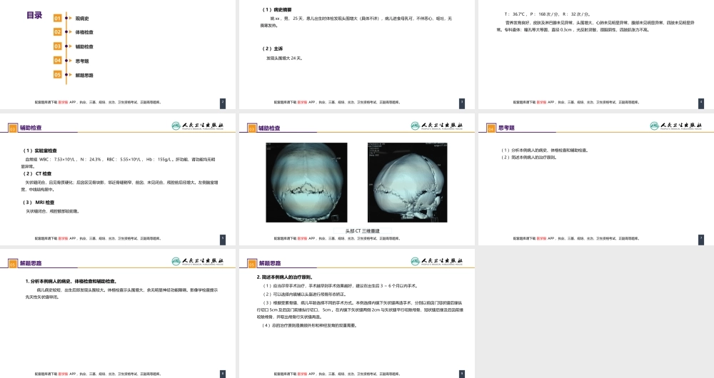 第二十一章 案例分析-矢状缝早闭(1).pptx